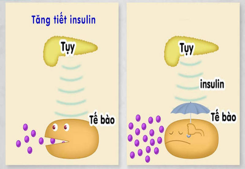 Nguyên nhân khiến đường máu tăng cao trong tiểu đường type 2